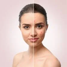 Dermatoloji